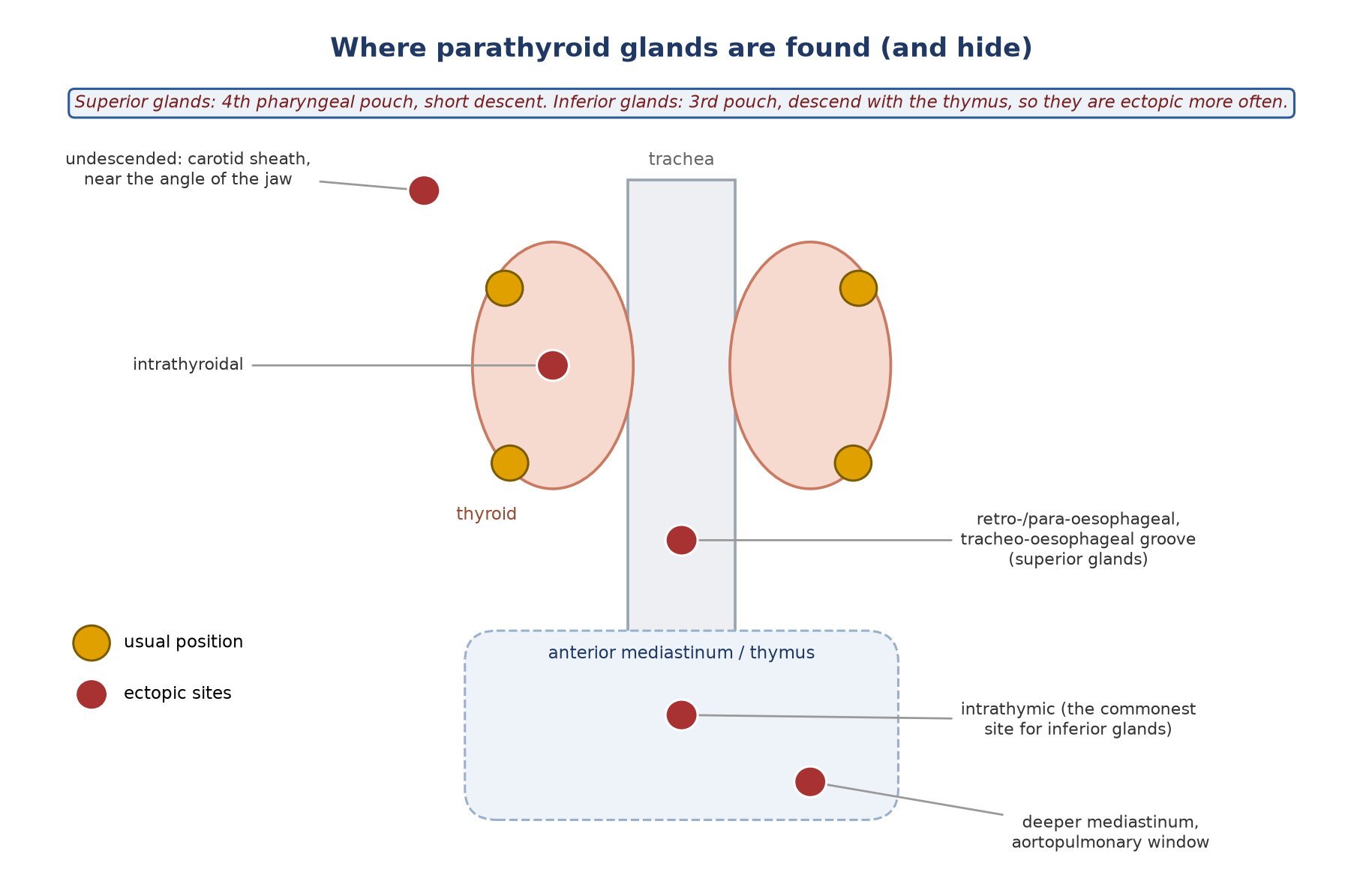 Normal and ectopic parathyroid locations.