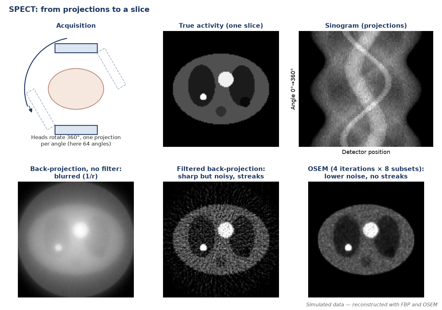SPECT acquisition diagram, a simulated activity slice and its sinogram, and reconstructions by unfiltered back-projection, filtered back-projection and OSEM.