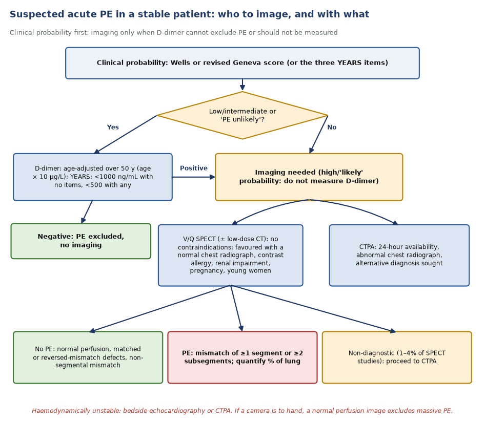 Flow chart: clinical probability, then D-dimer for low or intermediate probability, then imaging with V/Q SPECT or CTPA, and the three possible V/Q SPECT results.
