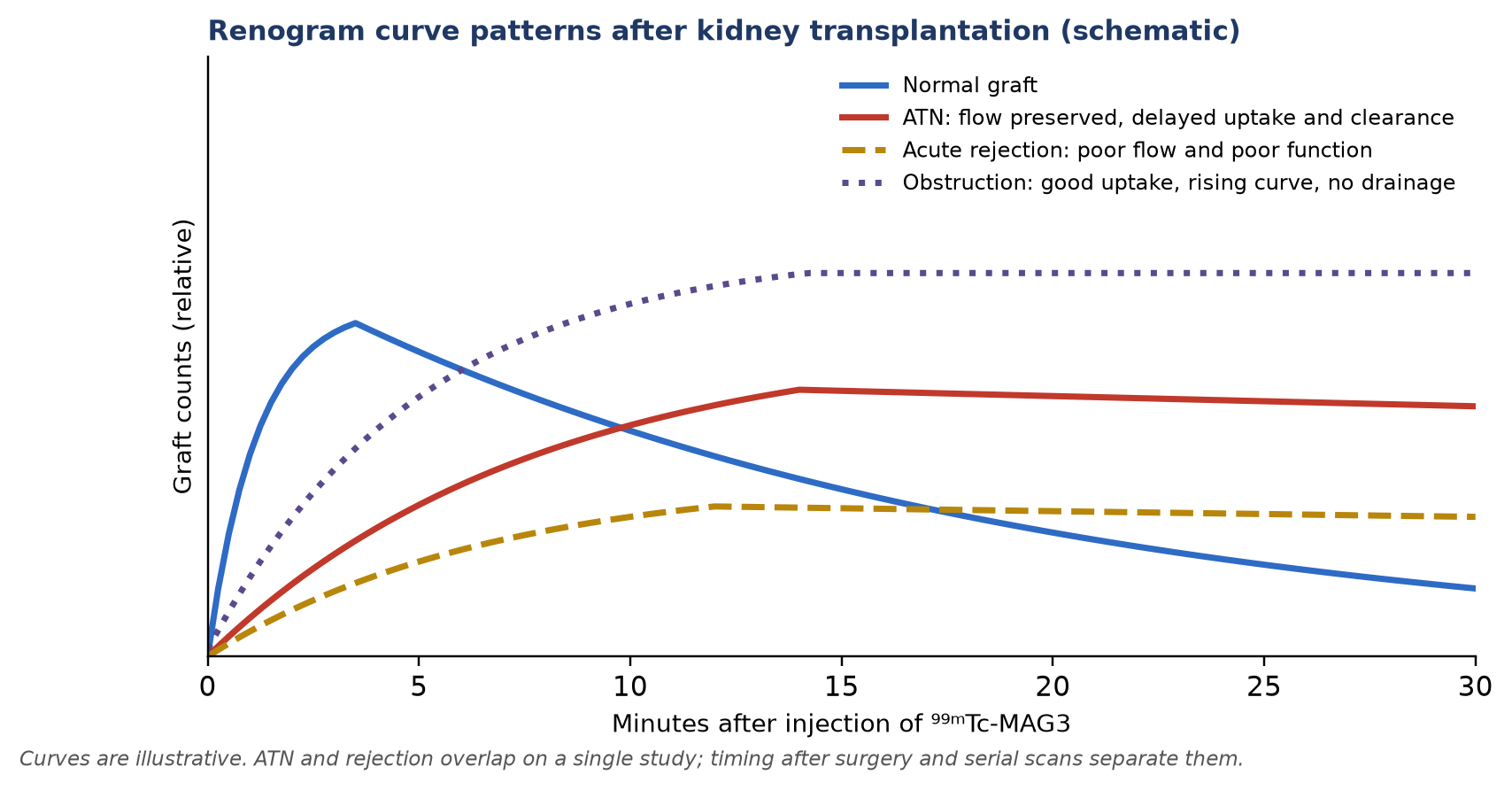 Typical renogram curve shapes (schematic).